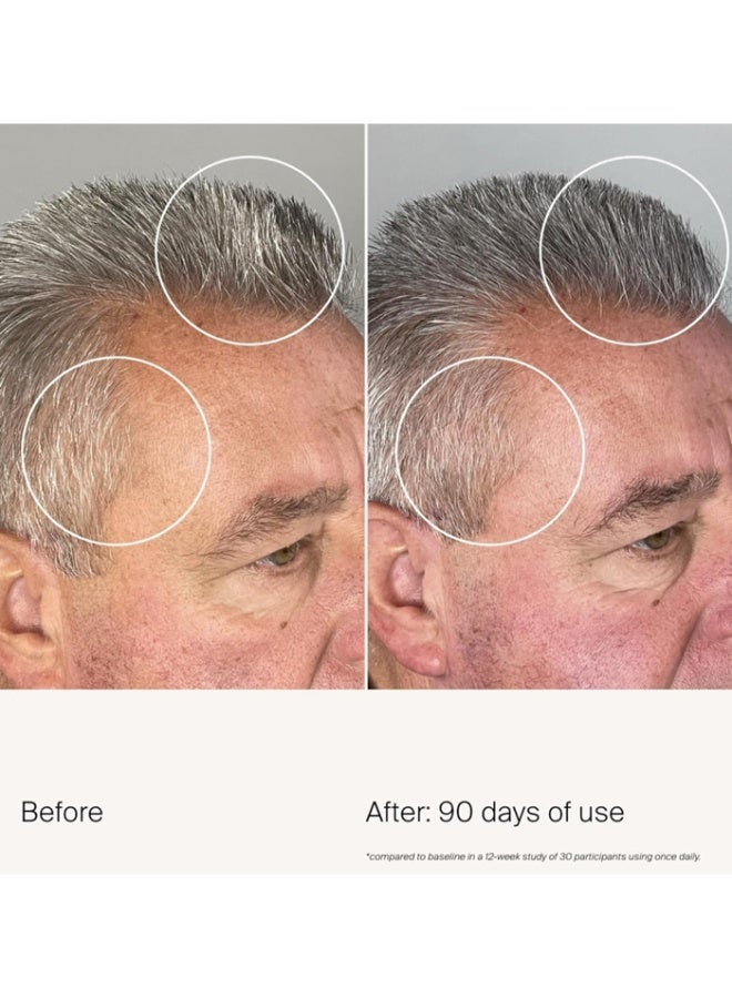 Living proof Scalp Care Density Serum - 50ml - Image 5